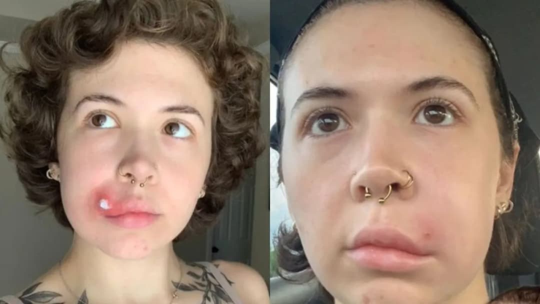 Trójkąt śmierci objawy – nie lekceważ tych groźnych sygnałów